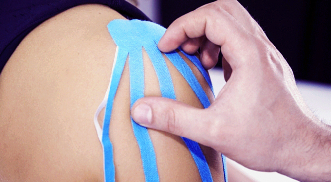 Kinesiologisches Taping